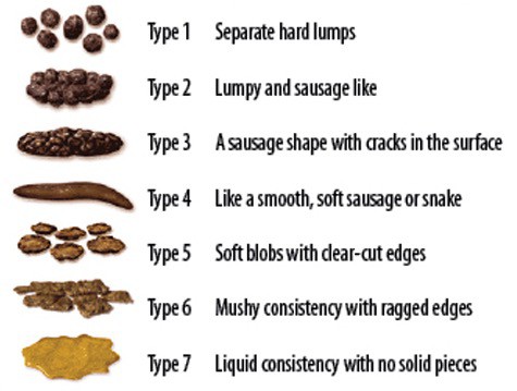 Bristol Stool Chart