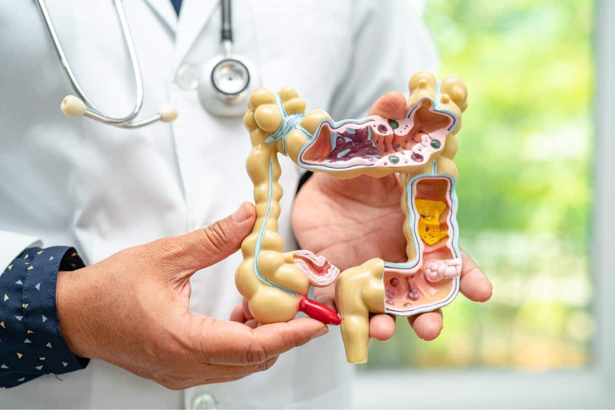 A doctor holding a model of the digestive system for educational purposes.