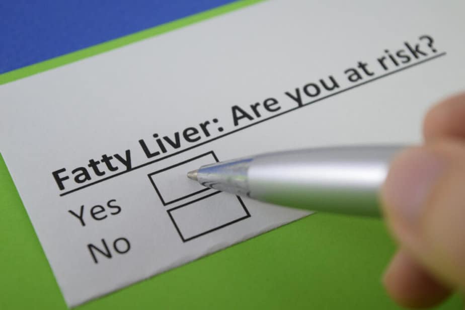 Fatty Liver Disease