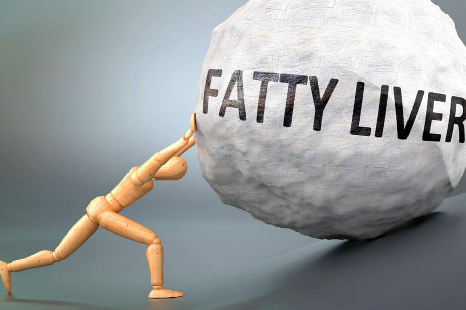 Fatty Liver Disease