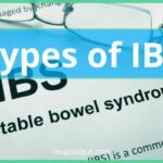 Types of IBS can include different forms and manifestations.