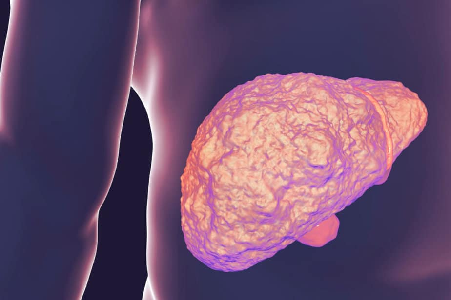 Liver Cirrhosis Symptoms, Causes & Treatment