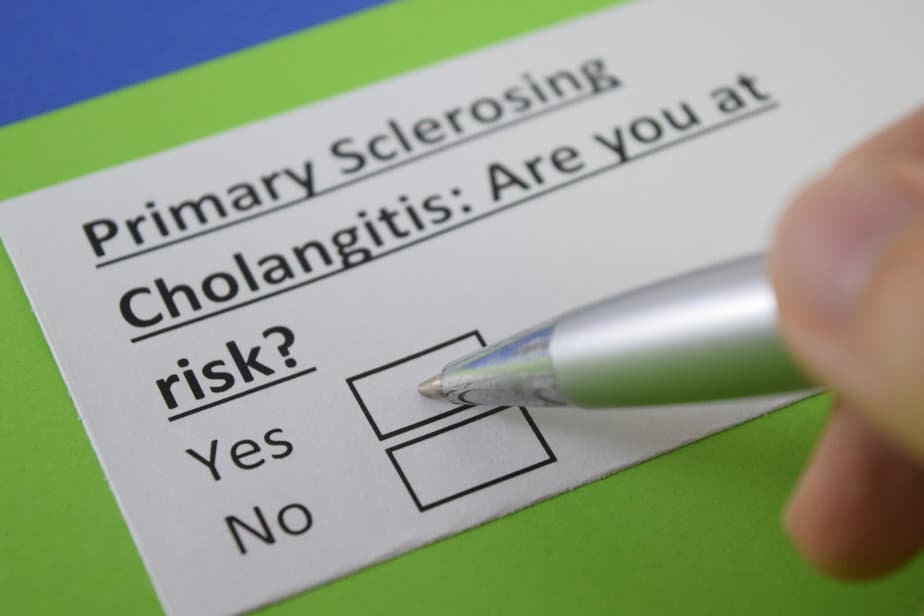Primary Sclerosing Cholangitis: Causes, Symptoms & Treatment