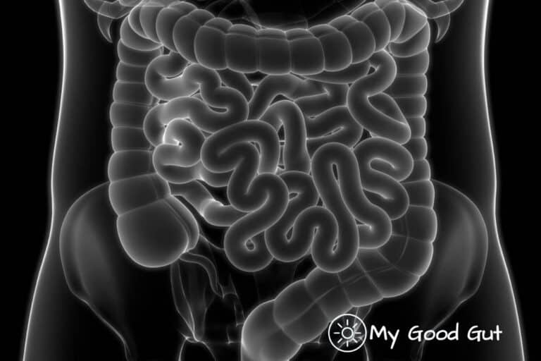 Small Intestinal Bacterial Overgrowth (SIBO) Overview
