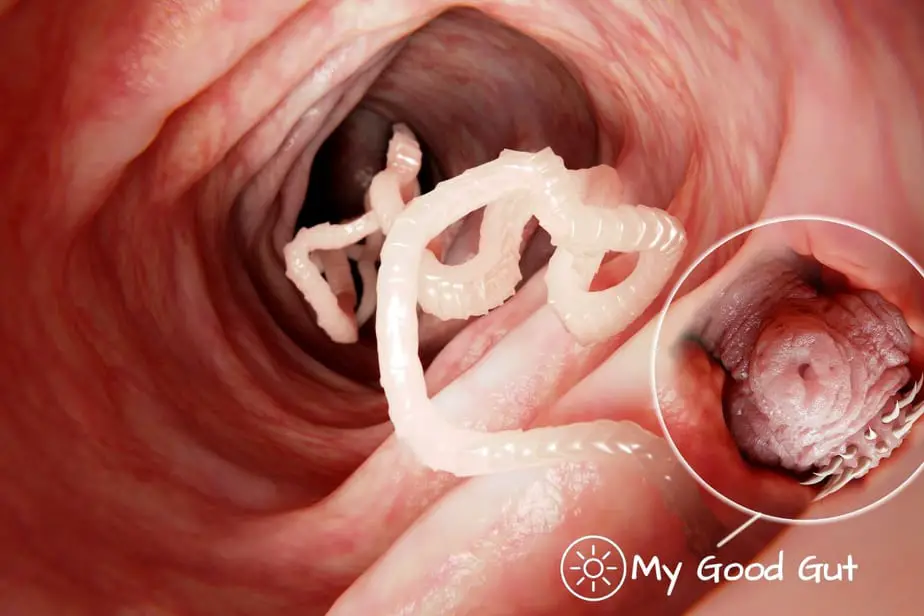 Tapeworm Overview - Symptoms, Treatment, and Prevention