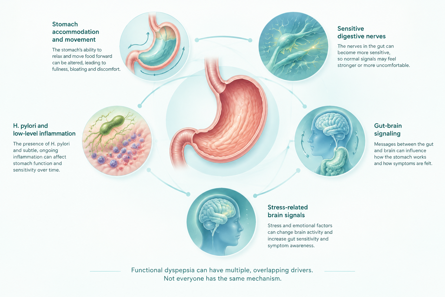 Functional dyspepsia drivers including stomach sensitivity, gut-brain signaling, and H. pylori
