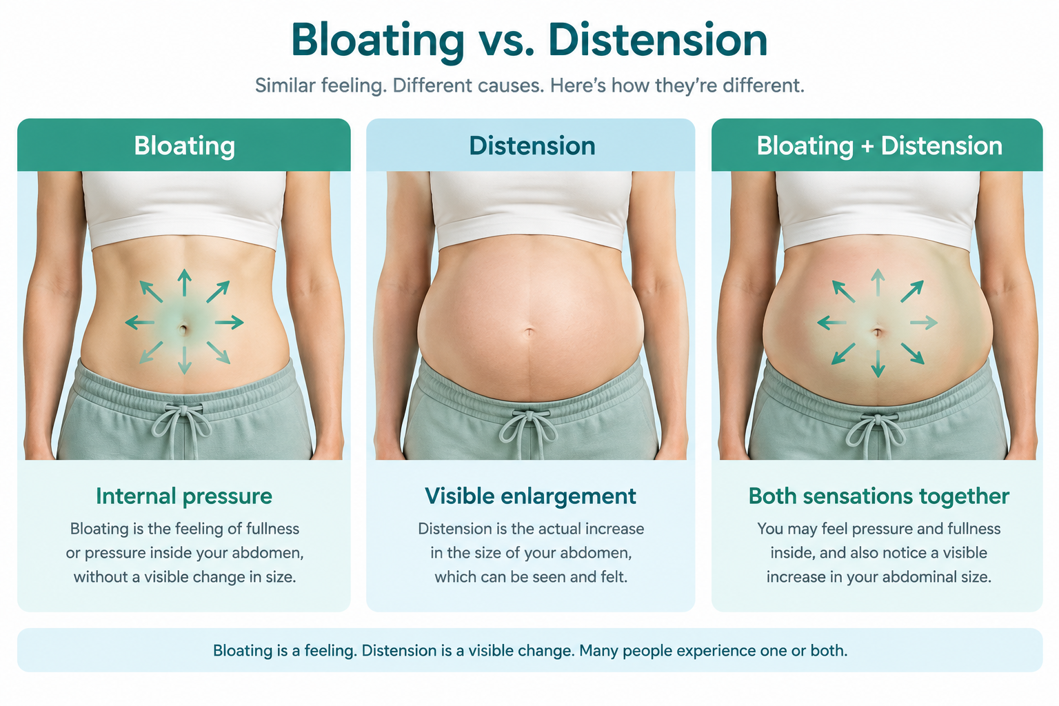Visual comparison of bloating sensation and abdominal distension