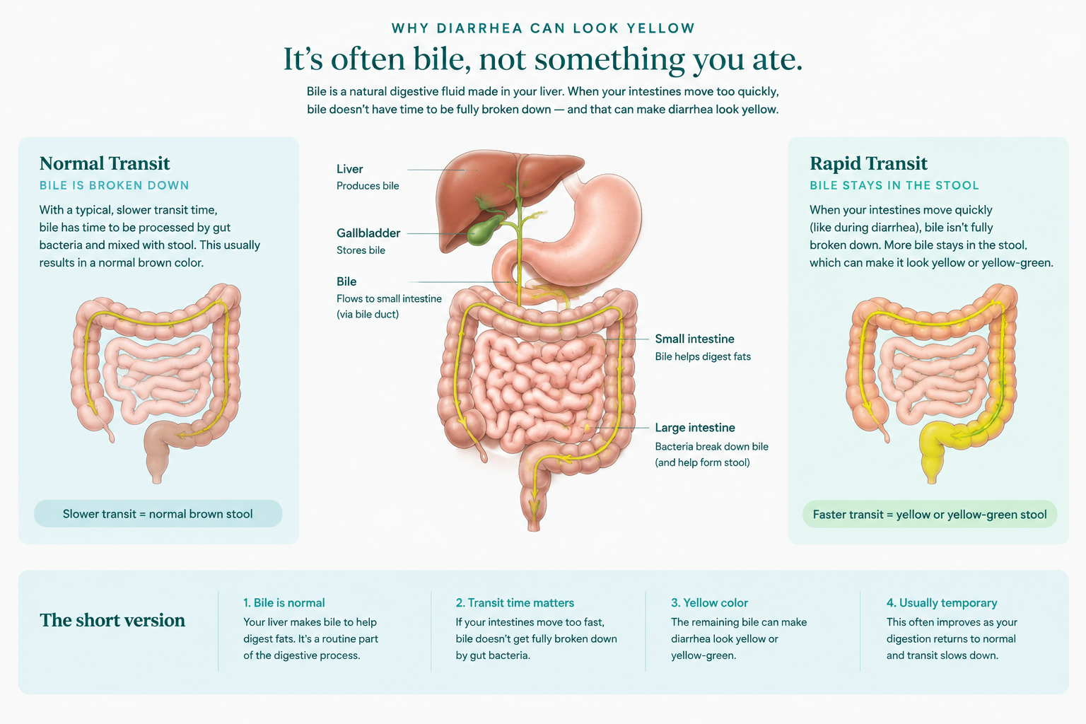 Medical illustration explaining yellow diarrhea and rapid intestinal transit